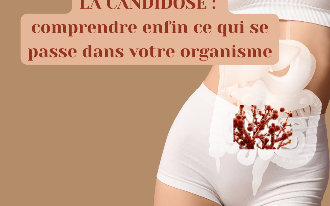 La candidose : comprendre enfin ce qui se passe dans votre organisme